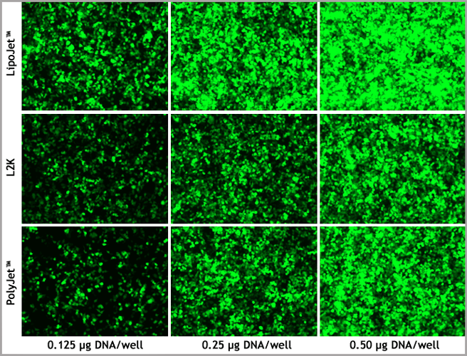 LipoJet_LIPO2000_POLYJET_Comparison_HEK293